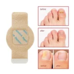 Generic Fungal Nail Patches (Yellow) - Image 4