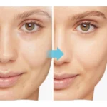 Generic Pack of 2 Gel Face Mask (Blue) - Image 2